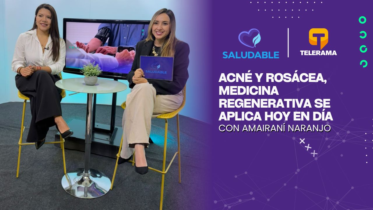 Acné y rosácea, medicina regenerativa se aplica hoy en día