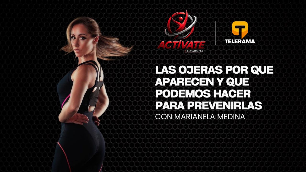 Las ojeras por que aparecen y que podemos hacer para prevenirlas